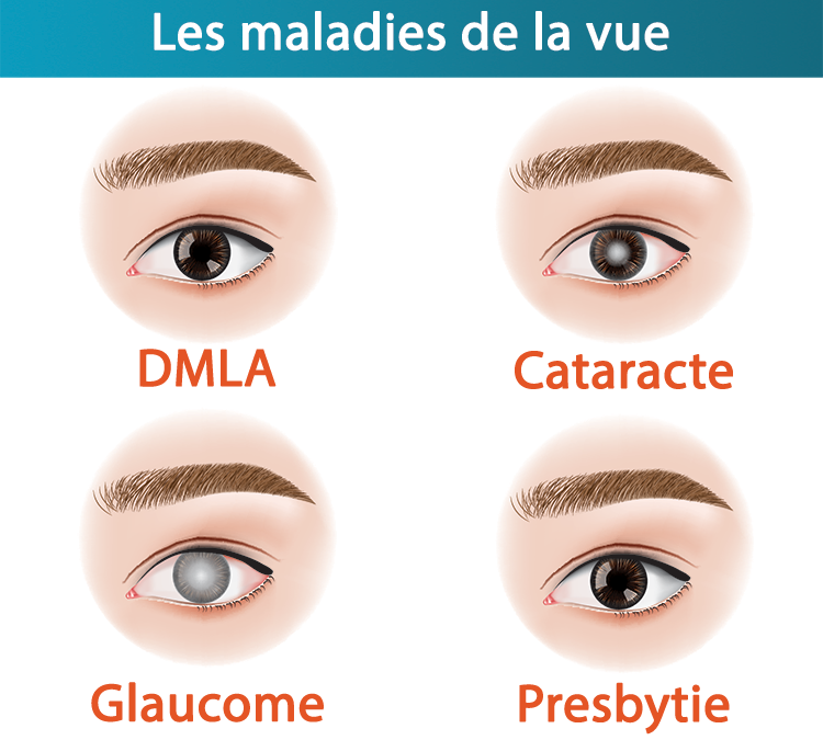 Les troubles de la vision chez les seniors de plus de 60 ans