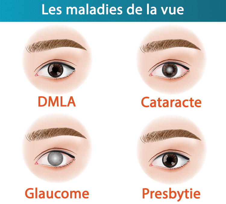 Maladie de loeil senior