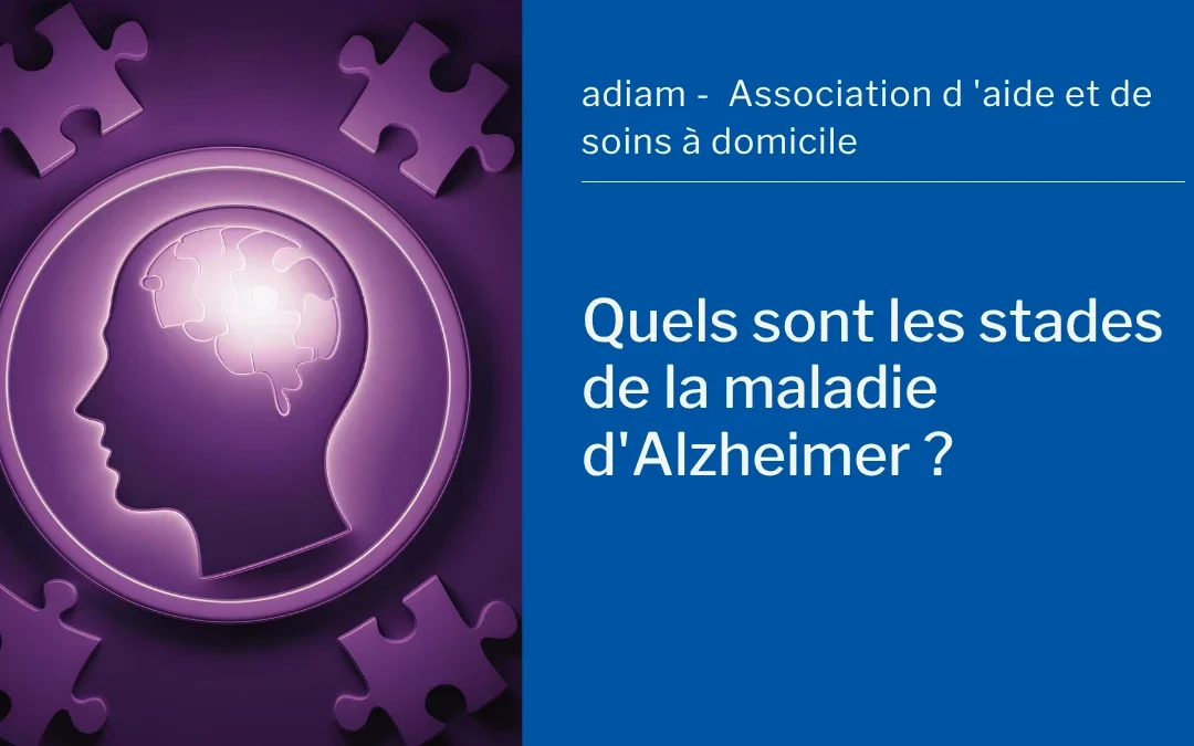 Quels sont les stades de la maladie d&rsquo;Alzheimer ?